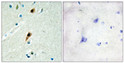 Immunohistochemistry analysis of paraffin-embedded human brain tissue, using RBM5 Antibody. The picture on the right is blocked with the synthesized peptide.