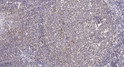Immunohistochemical analysis of paraffin-embedded human tonsil. 1, Tris-EDTA, pH 9.0 was used for antigen retrieval. 2, STJ94035