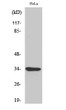Western Blot analysis of various cells using MC2-R Polyclonal Antibody STJ94039