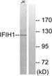 Western blot analysis of lysates from Jurkat cells, using IFIH1 Antibody. The lane on the right is blocked with the synthesized peptide.