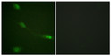 Immunofluorescence analysis of NIH/3T3 cells, using MDM2 Antibody. The picture on the right is blocked with the synthesized peptide.
