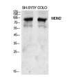 Western blot analysis of various cells using MDM2 Polyclonal Antibody diluted at 1：2000