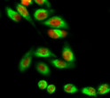 Immunofluorescence analysis of Hela cell. 1, MDM2 Polyclonal Antibody (red) was diluted at 1:200 (4°C overnight). LC3B Polyclonal Antibody (green) was diluted at 1:200 (4°C overnight). 2, Goat Anti Rabbit Alexa Fluor 594 Catalog: (NA was diluted at 1:1000 (room temperature, 50min). Goat Anti Mouse Alexa Fluor 488 Catalog: (NA was diluted at 1:1000 (room temperature, 50min).