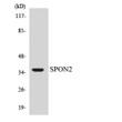 Western blot analysis of the lysates from HUVEC cells using SPON2 antibody. STJ94128