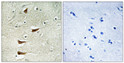 Immunohistochemistry analysis of paraffin-embedded human brain tissue, using MAP3K10 Antibody. The picture on the right is blocked with the synthesized peptide.