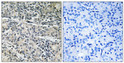 Immunohistochemistry analysis of paraffin-embedded human prostate carcinoma tissue, using MP68 Antibody. The picture on the right is blocked with the synthesized peptide.