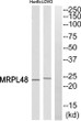 Western blot analysis of MRPL48 Antibody. The lane on the right is blocked with the MRPL48 peptide. STJ94232