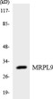Western blot analysis of the lysates from HUVEC cells using MRPL9 antibody. STJ94238
