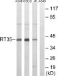 Western blot analysis of lysates from Jurkat, COLO, and A549 cells, using MRPS35 Antibody. The lane on the right is STJ94254
