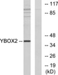 Western blot analysis of lysates from COLO205 cells, using YBOX2 Antibody. The lane on the right was blocked with the STJ94271