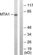 Western blot analysis of lysates from Jurkat cells, using MTA1 Antibody. The lane on the right was blocked with the STJ94272