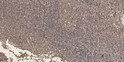 Immunohistochemical analysis of paraffin-embedded human tonsil. 1, Antibody was diluted at 1:200 (4°C overnight). 2, STJ94272