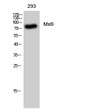 Western Blot analysis of 293 cells using MxB Polyclonal Antibody STJ94290