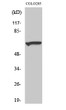 Western blot analysis of various cells using Myotubularin Polyclonal Antibody diluted at 1:500 STJ94317