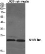 Western blot analysis of various cells using N/H/K-Ras polyclonal antibody diluted at 1:1000 STJ94325