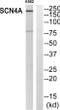 Western blot analysis of SCN4A Antibody. The lane on the right is blocked with the SCN4A peptide. STJ94331
