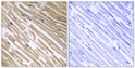 Immunohistochemistry analysis of paraffin-embedded human heart tissue, using NDRG4 Antibody. The picture on the right is blocked with the synthesized peptide.