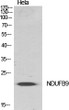 Western blot analysis of various cells using NDUFB9 Polyclonal Antibody diluted at 1:500 Western blot analysis of various cells using NDUFB9 Polyclonal Antibody diluted at 1:500