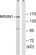 Western blot analysis of lysates from Jurkat cells, using NRXN1 Antibody. The lane on the right was blocked with the STJ94421