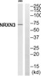 Western blot analysis of NRXN3 antibody. The lane on the right is blocked with the NRXN3 peptide. STJ94422