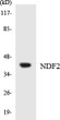 Western blot analysis of the lysates from COLO205 cells using NDF2 antibody. STJ94427