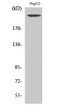 Western Blot analysis of various cells using Neurofibromin Polyclonal Antibody STJ94430