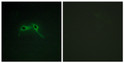 Immunofluorescence analysis of HepG2 cells using NF1 Antibody. The picture on the right is blocked with the synthesized STJ94430