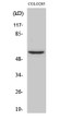 Western blot analysis of HeLa cells using Neuroglycan C Polyclonal Antibody STJ94431