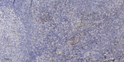 Immunohistochemical analysis of paraffin-embedded human tonsil. 1, Antibody was diluted at 1:200 (4° overnight). 2, STJ94432