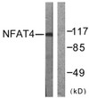 Western blot analysis of lysates from HeLa cells, treated with Ca2+ 40 nM 30', using NFAT4 Antibody. The lane on the STJ94448