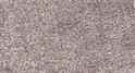 Immunohistochemical analysis of paraffin-embedded human spleen. 1, Tris-EDTA, pH 9.0 was used for antigen retrieval. 2, STJ94456
