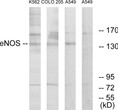 Western blot analysis of lysates from A549, K562, and COLO205 cells, using eNOS Antibody. The lane on the right is blocked with the synthesized peptide.