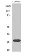 Western blot analysis of various cells using NRIP3 polyclonal antibody STJ94557