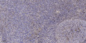 Immunohistochemical analysis of paraffin-embedded human tonsil. 1, Antibody was diluted at 1:200 (4° overnight). 2, STJ94557