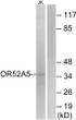 Western blot analysis of lysates from Jurkat cells, using OR52A5 Antibody. The lane on the right is blocked with the synthesized peptide.