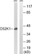Western blot analysis of lysates from 293 cells, using OR52K1 Antibody. The lane on the right is blocked with the synthesized peptide.