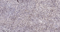Immunohistochemical analysis of paraffin-embedded human spleen. 1, Antibody was diluted at 1:200 (4° overnight). 2, STJ94833
