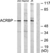Western blot analysis of lysates from HepG2, Jurkat, and 293 cells, using ACRBP Antibody. The lane on the right was STJ94848