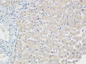Immunohistochemical analysis of paraffin-embedded Human Right liver. 1, Antibody was diluted at 1:100 (4°C overnight). 2, High-pressure and temperature EDTA, pH8.0 was used for antigen retrieval. 3, Secondary antibody was diluted at 1:200 (room temperature, 30min).