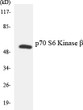 Western blot analysis of the lysates from HUVEC cells using p70 S6 Kinase β antibody. STJ94924
