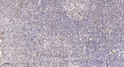 Immunohistochemical analysis of paraffin-embedded human tonsil. 1, Antibody was diluted at 1:200 (4° overnight). 2, STJ94924