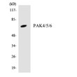 Western blot analysis of the lysates from Jurkat cells using PAK4/5/6 antibody.
