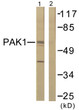 Western blot analysis of lysates from 293 cells, treated with Etoposide 25uM 60', using PAK1 Antibody. The lane on the right is blocked with the synthesized peptide.