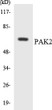 Western blot analysis of the lysates from COLO205 cells using PAK2 antibody.