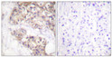 Immunohistochemistryt analysis of paraffin-embedded human brain, using PAK2 Antibody. The lane on the right is blocked with the PAK2 peptide.