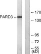 Western blot analysis of lysates from COLO205 cells, using PARD3 Antibody. The lane on the right is blocked with the STJ94955