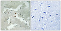 Immunohistochemical analysis of paraffin-embedded Human brain. Antibody was diluted at 1:100 (4°C overnight). High-pressure and temperature Tris-EDTA, pH8.0 was used for antigen retrieval. Negetive contrl (right) obtaned from antibody was pre-absorbed by immunogen peptide.