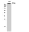 Western Blot analysis of A549 cells using PEG3 Polyclonal Antibody STJ95024