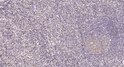 Immunohistochemical analysis of paraffin-embedded human tonsil. 1, Tris-EDTA, pH 9.0 was used for antigen retrieval. 2, STJ95052