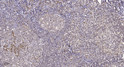 Immunohistochemical analysis of paraffin-embedded human tonsil. 1, Tris-EDTA, pH 9.0 was used for antigen retrieval. 2, STJ95062